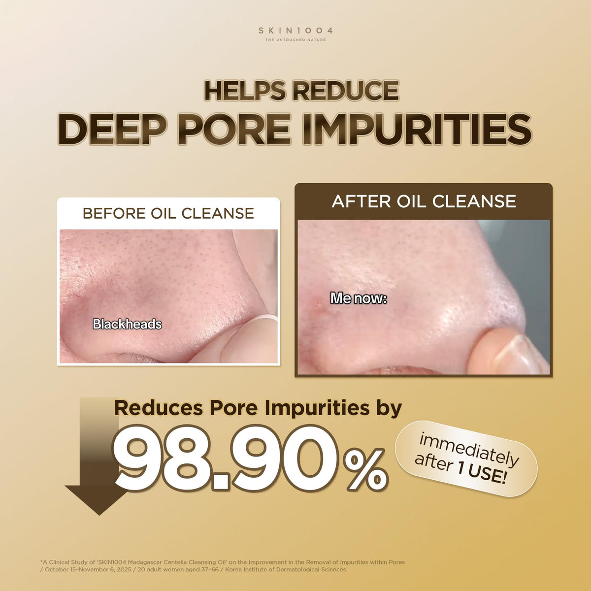SKIN1004 Madagascar Centella Light Cleansing Oil, Gentle Pore Cleansing Oil for Makeup and Sunscreen, 200 mL