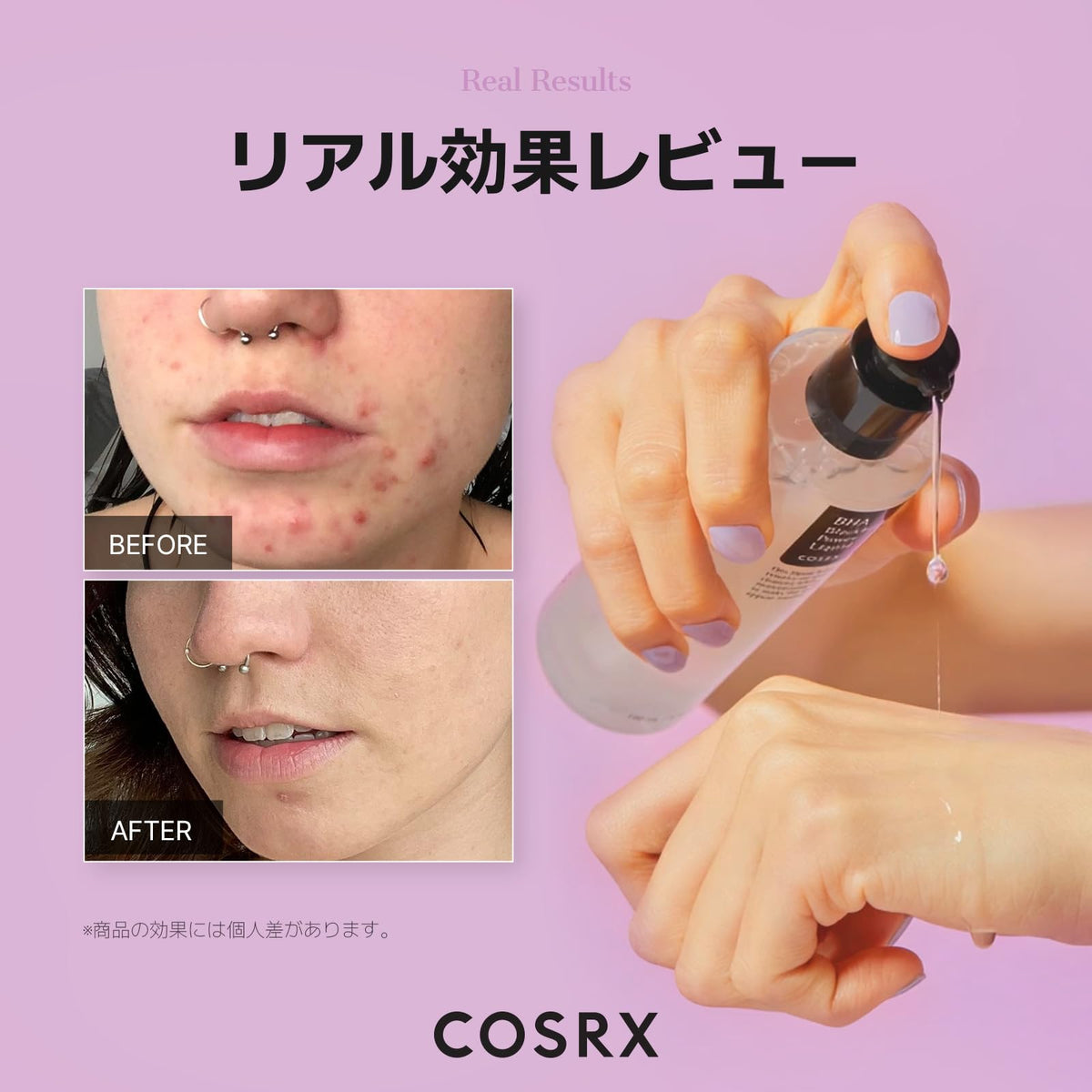 COSRX BHA Blackhead Power Liquid, 4% Betaine Salicylate Weakly Acidic Pore Care Essence, 100 mL
