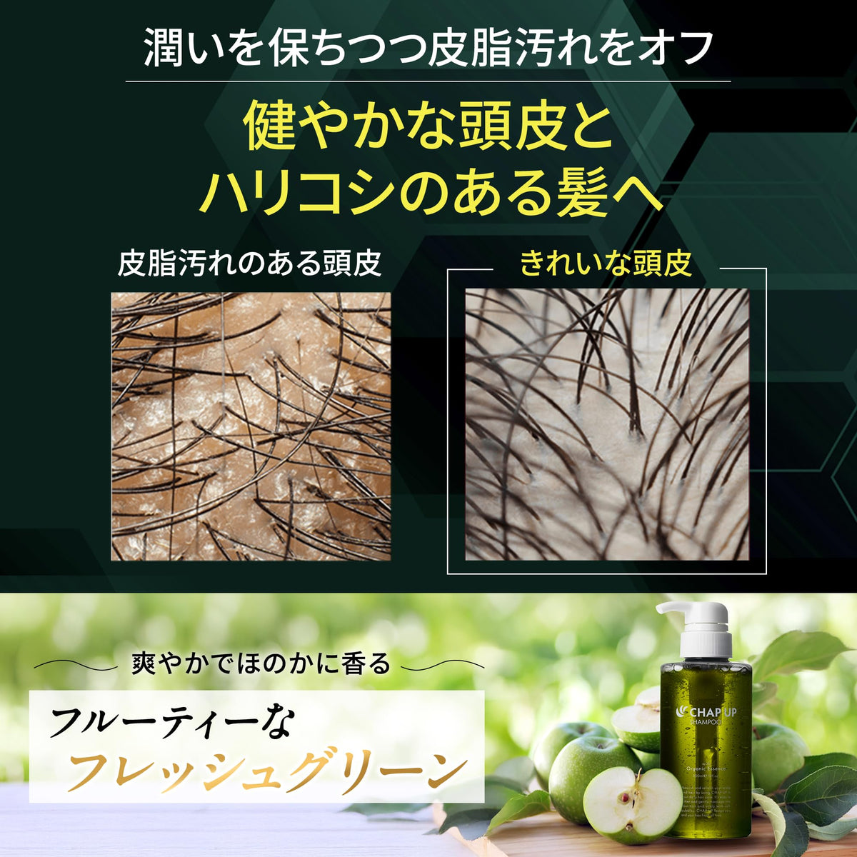 Chapup Rinse-in Scalp Shampoo, Amino Acid Non-Silicone Men's Shampoo with 10 Plant Extracts, Fresh Green Scent, 300 mL Bottle or Refill